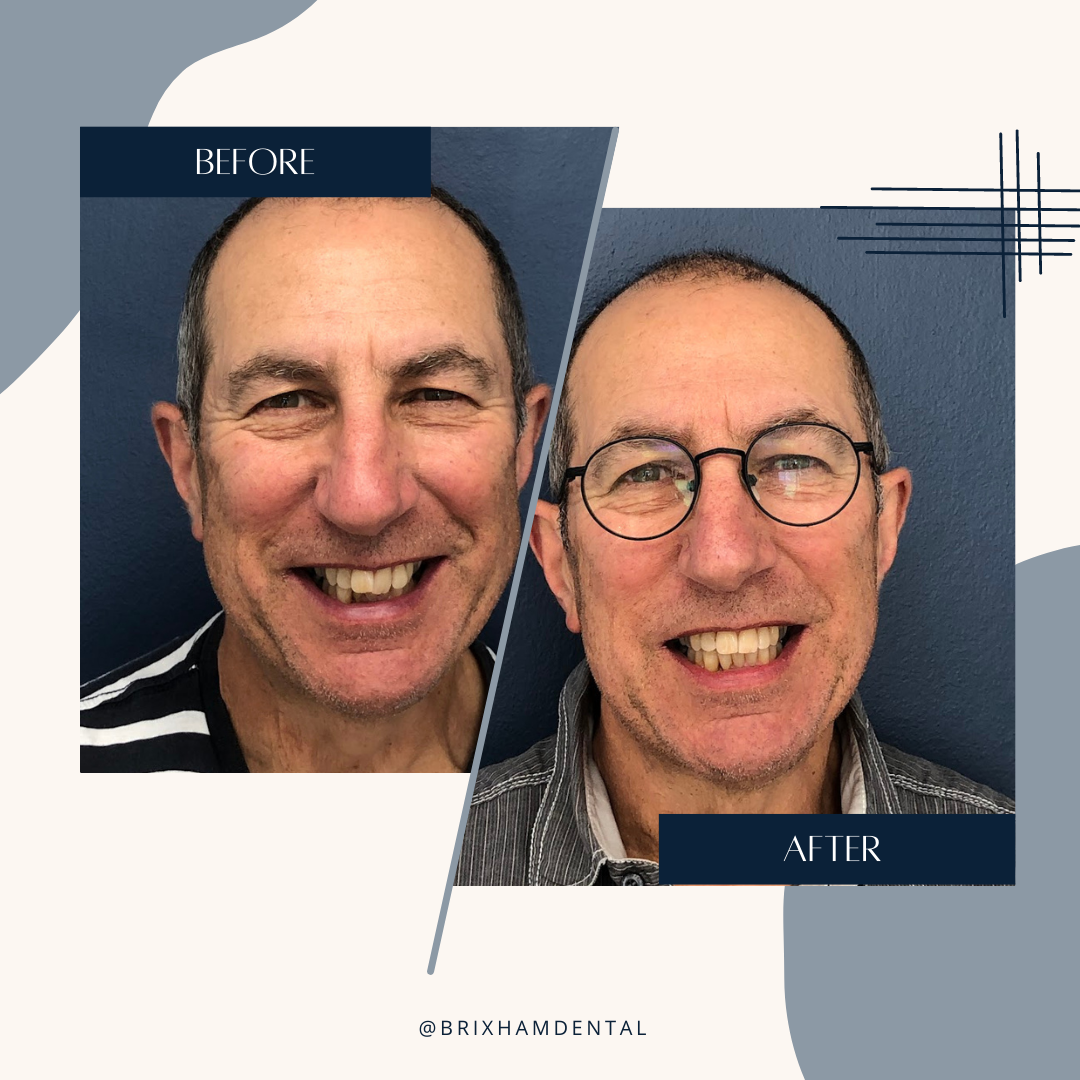 Before and after dental treatment - Jon Winks